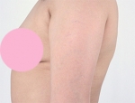 Faceline Plastic Surgery, Reviews,Images,Promotions — Korea cost, reviews & before-after | MISOODA