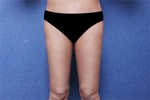 Deesse Plastic Surgery, Reviews,Images, Promotions — Korea cost, reviews & before-after | MISOODA