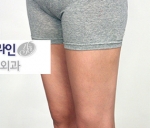 Faceline Plastic Surgery, Reviews,Images,Promotions — Korea cost, reviews & before-after | MISOODA