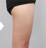 DA Plastic Surgery, Reviews, Images, Promotions — Korea cost, reviews & before-after | MISOODA