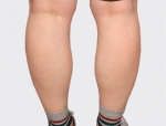 Faceline Plastic Surgery, Reviews,Images,Promotions — Korea cost, reviews & before-after | MISOODA