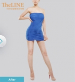 Theline Plastic Surgery,Reviews,Images, Promotions — Korea cost, reviews & before-after | MISOODA
