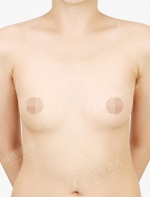 View Plastic Surgery, Reviews, Images, Promotions — Korea cost, reviews & before-after | MISOODA
