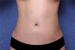 Deesse Plastic Surgery, Reviews,Images, Promotions — Korea cost, reviews & before-after | MISOODA