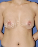 April 31 Plastic Surgery,Reviews,Images,Promotions — Korea cost, reviews & before-after | MISOODA