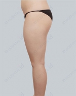 ID Plastic Surgery , Reviews, Images, Promotions — Korea cost, reviews & before-after | MISOODA
