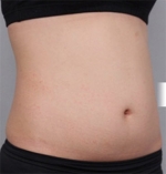 DA Plastic Surgery, Reviews, Images, Promotions — Korea cost, reviews & before-after | MISOODA