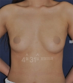 April 31 Plastic Surgery,Reviews,Images,Promotions — Korea cost, reviews & before-after | MISOODA