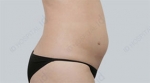 ID Plastic Surgery , Reviews, Images, Promotions — Korea cost, reviews & before-after | MISOODA