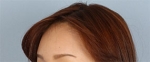 Banobagi Plastic Surgery,Reviews,Images, Promotions, MISOODA — Korea cost, reviews & before-after | MISOODA
