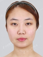View Plastic Surgery, Reviews, Images, Promotions — Korea cost, reviews & before-after | MISOODA