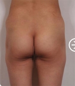 The Plastic Surgery, Reviews,Images, Promotions, — Korea cost, reviews & before-after | MISOODA