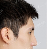 View Plastic Surgery, Reviews, Images, Promotions — Korea cost, reviews & before-after | MISOODA