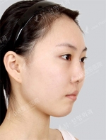 View Plastic Surgery, Reviews, Images, Promotions — Korea cost, reviews & before-after | MISOODA