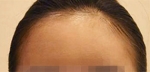 Faceline Plastic Surgery, Reviews,Images,Promotions — Korea cost, reviews & before-after | MISOODA