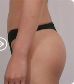 The Plastic Surgery, Reviews,Images, Promotions, — Korea cost, reviews & before-after | MISOODA