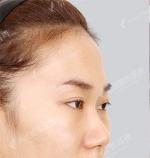 View Plastic Surgery, Reviews, Images, Promotions — Korea cost, reviews & before-after | MISOODA