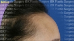 BK Plastic Surgery, Reviews, Images, Promotions — Korea cost, reviews & before-after | MISOODA