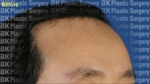 BK Plastic Surgery, Reviews, Images, Promotions — Korea cost, reviews & before-after | MISOODA