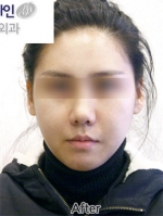 Faceline Plastic Surgery, Reviews,Images,Promotions — Korea cost, reviews & before-after | MISOODA
