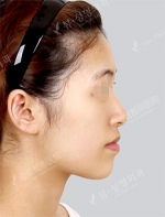View Plastic Surgery, Reviews, Images, Promotions — Korea cost, reviews & before-after | MISOODA