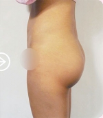 The Plastic Surgery, Reviews,Images, Promotions, — Korea cost, reviews & before-after | MISOODA