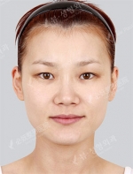 View Plastic Surgery, Reviews, Images, Promotions — Korea cost, reviews & before-after | MISOODA