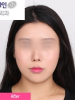 Faceline Plastic Surgery, Reviews,Images,Promotions — Korea cost, reviews & before-after | MISOODA