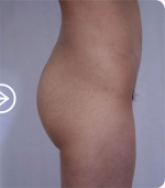 The Plastic Surgery, Reviews,Images, Promotions, — Korea cost, reviews & before-after | MISOODA