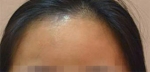 Faceline Plastic Surgery, Reviews,Images,Promotions — Korea cost, reviews & before-after | MISOODA