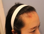 Banobagi Plastic Surgery,Reviews,Images, Promotions, MISOODA — Korea cost, reviews & before-after | MISOODA