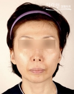 Theline Plastic Surgery,Reviews,Images, Promotions — Korea cost, reviews & before-after | MISOODA