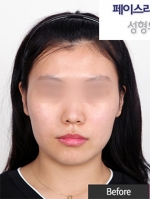 Faceline Plastic Surgery, Reviews,Images,Promotions — Korea cost, reviews & before-after | MISOODA