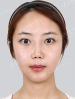 View Plastic Surgery, Reviews, Images, Promotions — Korea cost, reviews & before-after | MISOODA