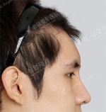 View Plastic Surgery, Reviews, Images, Promotions — Korea cost, reviews & before-after | MISOODA