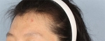 Banobagi Plastic Surgery,Reviews,Images, Promotions, MISOODA — Korea cost, reviews & before-after | MISOODA
