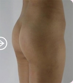 The Plastic Surgery, Reviews,Images, Promotions, — Korea cost, reviews & before-after | MISOODA