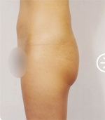 The Plastic Surgery, Reviews,Images, Promotions, — Korea cost, reviews & before-after | MISOODA