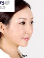Faceline Plastic Surgery, Reviews,Images,Promotions — Korea cost, reviews & before-after | MISOODA