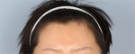 Banobagi Plastic Surgery,Reviews,Images, Promotions, MISOODA — Korea cost, reviews & before-after | MISOODA