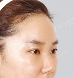 View Plastic Surgery, Reviews, Images, Promotions — Korea cost, reviews & before-after | MISOODA