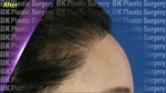 BK Plastic Surgery, Reviews, Images, Promotions — Korea cost, reviews & before-after | MISOODA