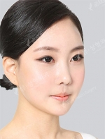 View Plastic Surgery, Reviews, Images, Promotions — Korea cost, reviews & before-after | MISOODA