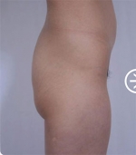 The Plastic Surgery, Reviews,Images, Promotions, — Korea cost, reviews & before-after | MISOODA