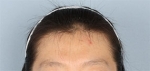 Banobagi Plastic Surgery,Reviews,Images, Promotions, MISOODA — Korea cost, reviews & before-after | MISOODA