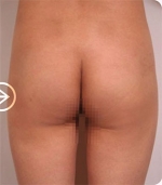 The Plastic Surgery, Reviews,Images, Promotions, — Korea cost, reviews & before-after | MISOODA