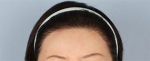 Banobagi Plastic Surgery,Reviews,Images, Promotions, MISOODA — Korea cost, reviews & before-after | MISOODA