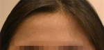 Faceline Plastic Surgery, Reviews,Images,Promotions — Korea cost, reviews & before-after | MISOODA