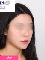 Faceline Plastic Surgery, Reviews,Images,Promotions — Korea cost, reviews & before-after | MISOODA