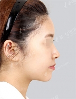 View Plastic Surgery, Reviews, Images, Promotions — Korea cost, reviews & before-after | MISOODA